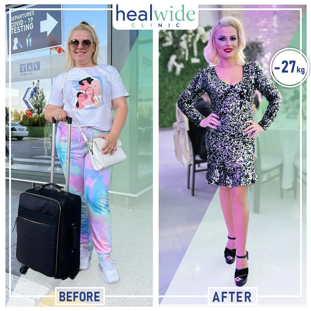 weight-loss-surgery-before-after