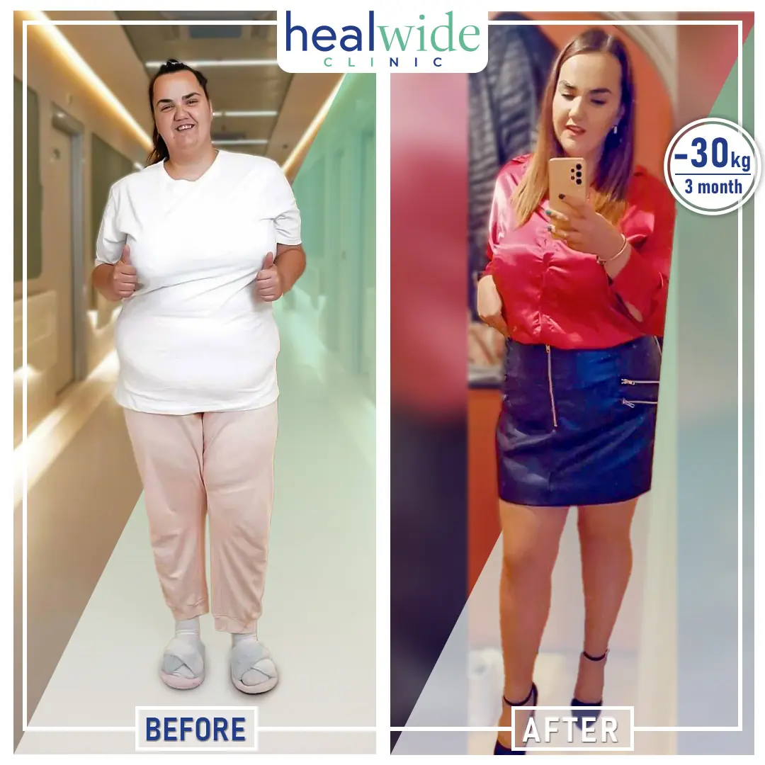 weight-loss-surgery-before-after