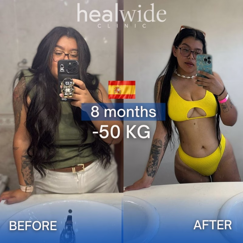 healwide clinic before after 5